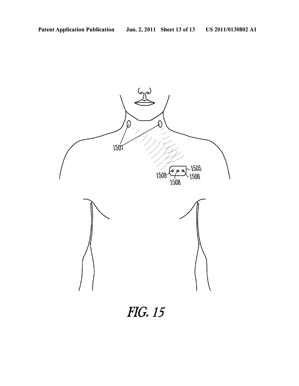 SYSTEM AND METHOD FOR TESTING NEURAL STIMULATION THRESHOLD - diagram, schematic, and image 14