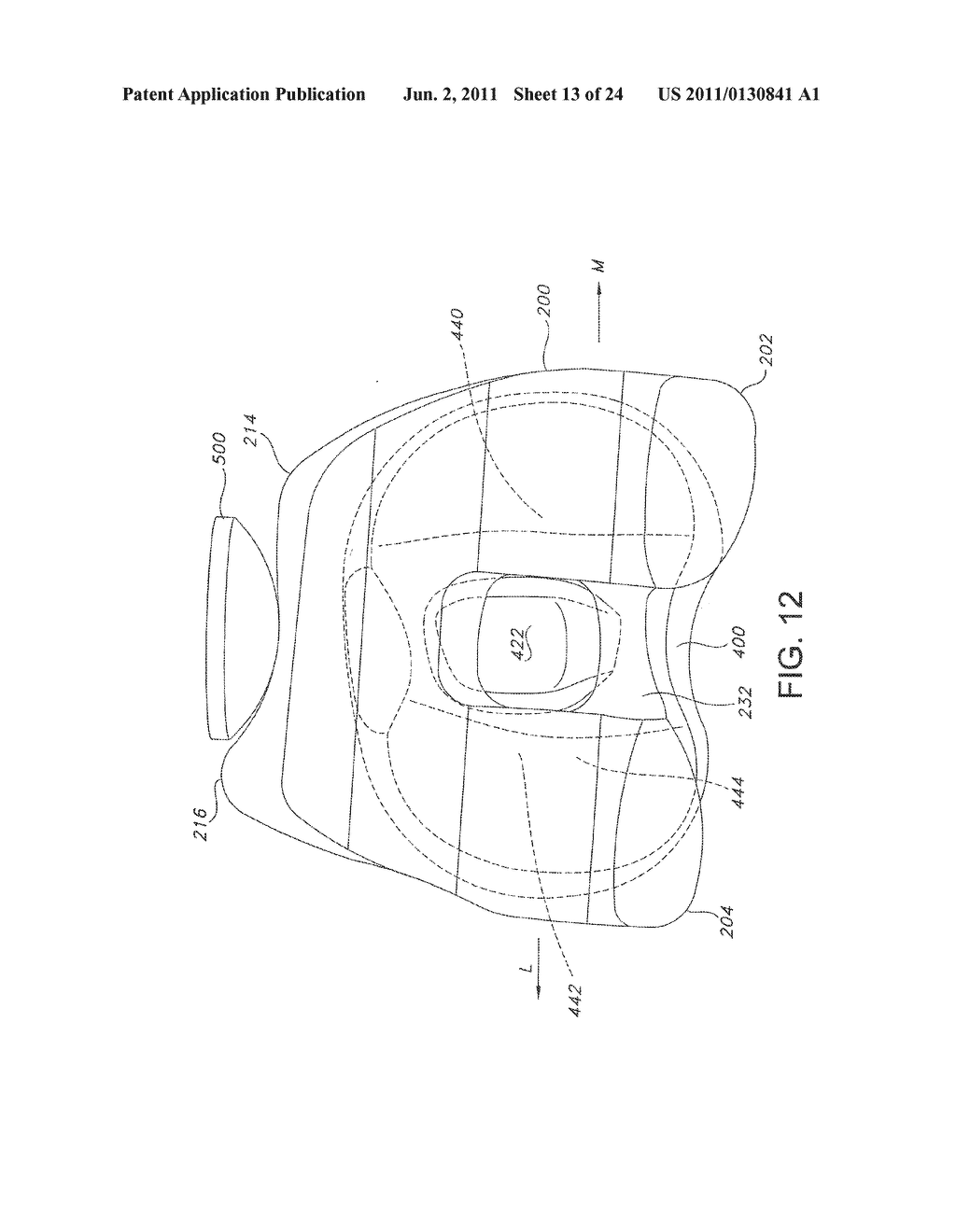 High Performance Knee Prostheses - diagram, schematic, and image 14