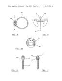 CUP COMPONENT OF AN ORTHOPAEDIC JOINT PROSTHESIS diagram and image