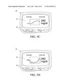 SYSTEMS AND METHODS FOR REPLACING SIGNAL ARTIFACTS IN A GLUCOSE SENSOR     DATA STREAM diagram and image