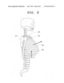 POSTURE-IMPROVING GARMENT diagram and image