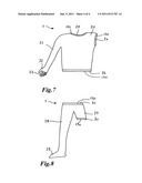 Protective device particularly for use for exterior prostheses diagram and image