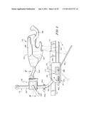 HEAD SUPPORT APPARATUS FOR SPINAL SURGERY diagram and image