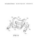 HEAD SUPPORT APPARATUS FOR SPINAL SURGERY diagram and image