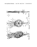 Selective Harvester diagram and image