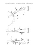 Selective Harvester diagram and image