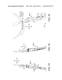 Selective Harvester diagram and image