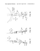 Selective Harvester diagram and image