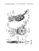 Selective Harvester diagram and image