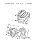 Mouth guard diagram and image