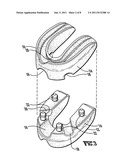 Mouth guard diagram and image