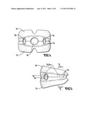 Mouth guard diagram and image