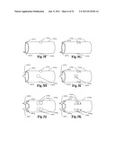 MODULAR SYSTEM INCLUDING SHAFT SEGMENTS HAVING CONFIGURATION AND BREAKDOWN     ATTACHMENTS diagram and image