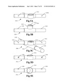 MODULAR SYSTEM INCLUDING SHAFT SEGMENTS HAVING CONFIGURATION AND BREAKDOWN     ATTACHMENTS diagram and image