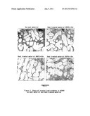 Aluminum Alloy Casting Material for Heat Treatment Excelling in Heat     Conduction and Process for Producing the Same diagram and image