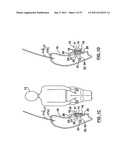 ACTIVE BOLSTER diagram and image