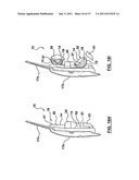 ACTIVE BOLSTER diagram and image