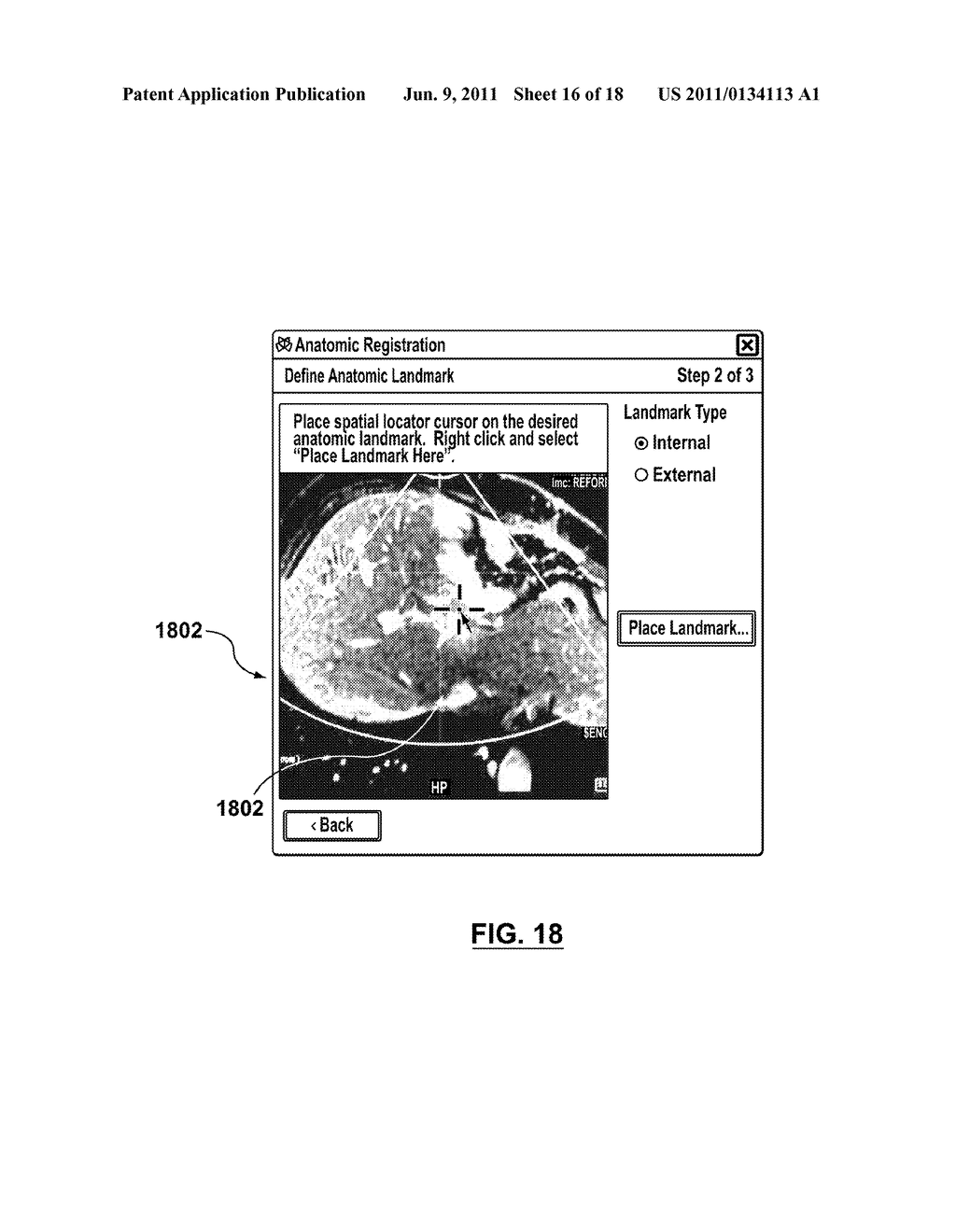 SYSTEMS AND METHODS FOR TRACKING POSITIONS BETWEEN IMAGING MODALITIES AND     TRANSFORMING A DISPLAYED THREE-DIMENSIONAL IMAGE CORRESPONDING TO A     POSITION AND ORIENTATION OF A PROBE - diagram, schematic, and image 17
