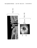 METHODS AND APPARATUS FOR OPTICAL COHERENCE TOMOGRAPHY SCANNING diagram and image