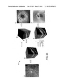 METHODS AND APPARATUS FOR OPTICAL COHERENCE TOMOGRAPHY SCANNING diagram and image