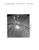 METHODS AND APPARATUS FOR OPTICAL COHERENCE TOMOGRAPHY SCANNING diagram and image