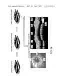 METHODS AND APPARATUS FOR OPTICAL COHERENCE TOMOGRAPHY SCANNING diagram and image