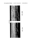 METHODS AND APPARATUS FOR OPTICAL COHERENCE TOMOGRAPHY SCANNING diagram and image