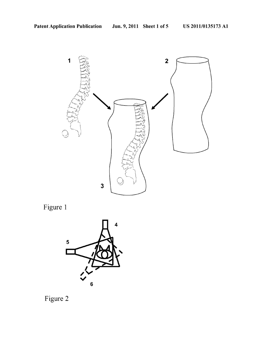 METHOD FOR 3D SPINE AND FULL 3D TRUNK IMAGING FUSION IN STANDING POSITION - diagram, schematic, and image 02
