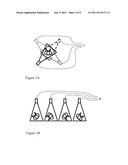 METHOD FOR 3D SPINE AND FULL 3D TRUNK IMAGING FUSION IN STANDING POSITION diagram and image