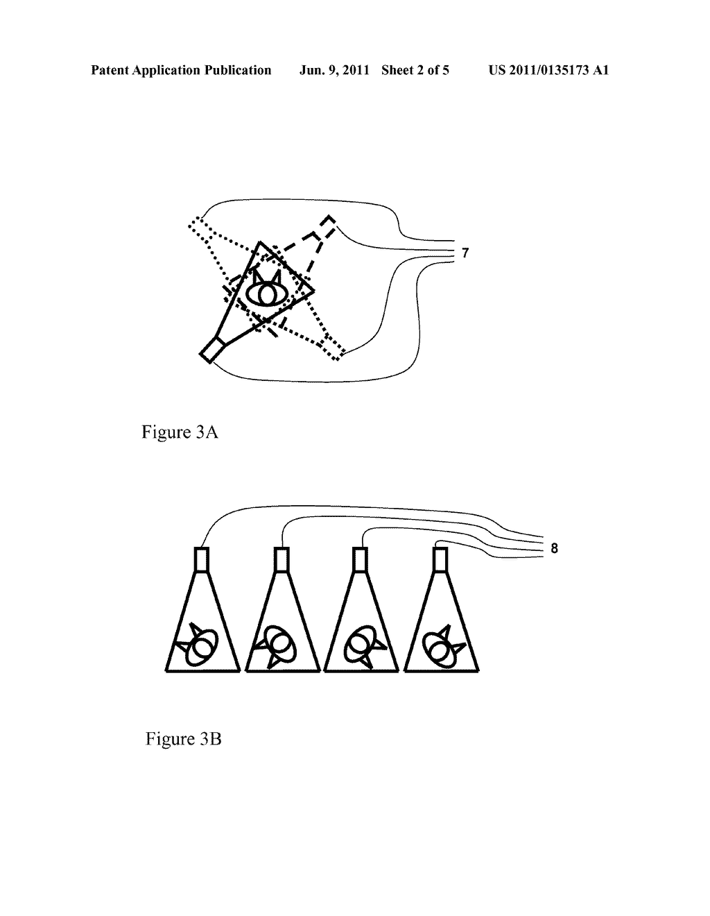 METHOD FOR 3D SPINE AND FULL 3D TRUNK IMAGING FUSION IN STANDING POSITION - diagram, schematic, and image 03