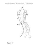 METHOD FOR 3D SPINE AND FULL 3D TRUNK IMAGING FUSION IN STANDING POSITION diagram and image