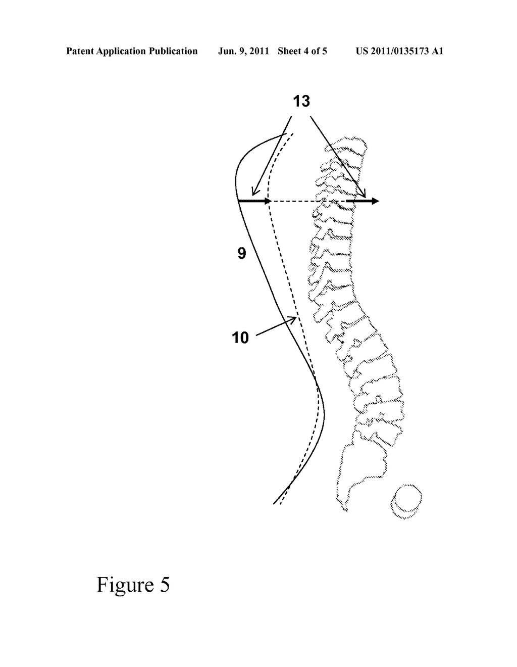 METHOD FOR 3D SPINE AND FULL 3D TRUNK IMAGING FUSION IN STANDING POSITION - diagram, schematic, and image 05