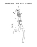 EXCHANGE CABLING METHOD AND APPARATUS diagram and image