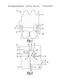 AXIAL RETENTION ASSEMBLY diagram and image