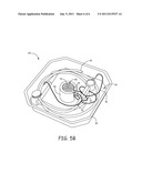 CONTAINER AND SYSTEM FOR DECONTAMINATING A MEDICAL DEVICE WITH A FOG diagram and image