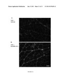 ACTRIIB PROTEINS AND VARIANTS AND USES THEREFORE RELATING TO UTROPHIN     INDUCTION FOR MUSCULAR DYSTROPHY THERAPY diagram and image