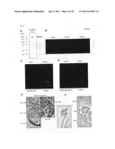 GENES AND POLYPEPTIDES RELATING TO BREAST CANCERS diagram and image