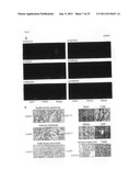 GENES AND POLYPEPTIDES RELATING TO BREAST CANCERS diagram and image