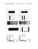 GENES AND POLYPEPTIDES RELATING TO BREAST CANCERS diagram and image