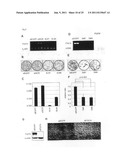 GENES AND POLYPEPTIDES RELATING TO BREAST CANCERS diagram and image