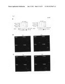 GENES AND POLYPEPTIDES RELATING TO BREAST CANCERS diagram and image