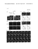 GENES AND POLYPEPTIDES RELATING TO BREAST CANCERS diagram and image