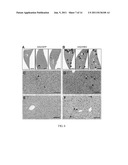 NON-HUMAN ANIMAL DISEASE MODEL FOR HEPATITIS B VIRUS-ASSOCIATED DISEASE diagram and image