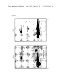 SERUM PROTEOMIC FOR FINDING DIAGNOSTIC MARKERS AND FOR MONITORING     THERAPEUTICAL INTERVENTION IN TREATMENT OF HEPATOCELLULAR CARCINOMA diagram and image