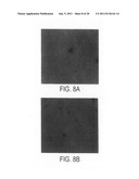 FIBROBLAST GROWTH PATTERNS FOR DIAGNOSIS OF ALZHEIMER S DISEASE diagram and image