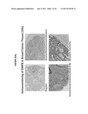 Monoclonal Antibodies Against GMF-B Antigens, and Uses Therefor diagram and image