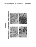 Monoclonal Antibodies Against GMF-B Antigens, and Uses Therefor diagram and image