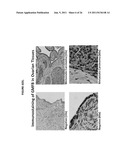 Monoclonal Antibodies Against GMF-B Antigens, and Uses Therefor diagram and image