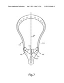 LACROSSE HEAD HAVING A BALL STOP diagram and image