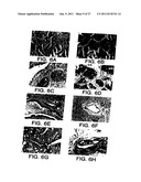 Survivin, a protein that inhibits cellular apoptosis, and its modulation diagram and image